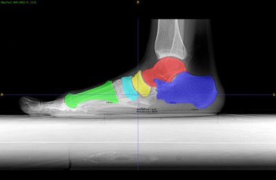 Medical Image Segmentation
